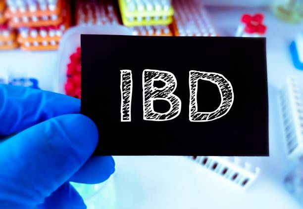 Read more about the article Inflammatory bowel disease[IBD]