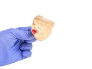 Doctor holds a mock intestines of a man on a white background. The concept of intestinal diseases and the treatment of colitis and enteritis, copy space, mucous