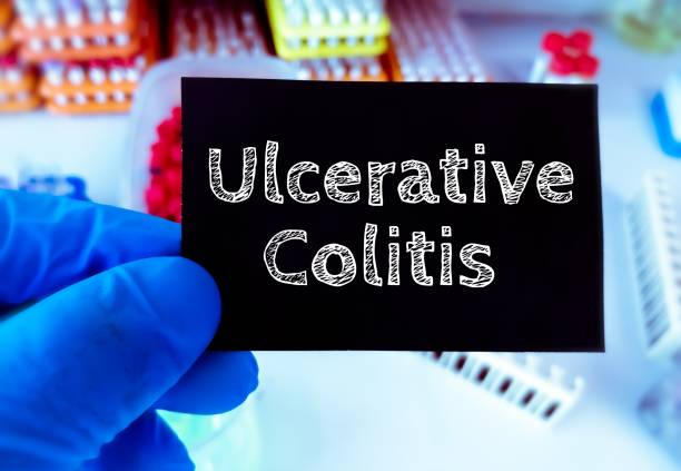 Read more about the article Ulcerative Colitis: Foods to eat and avoid with ulcerative colitis