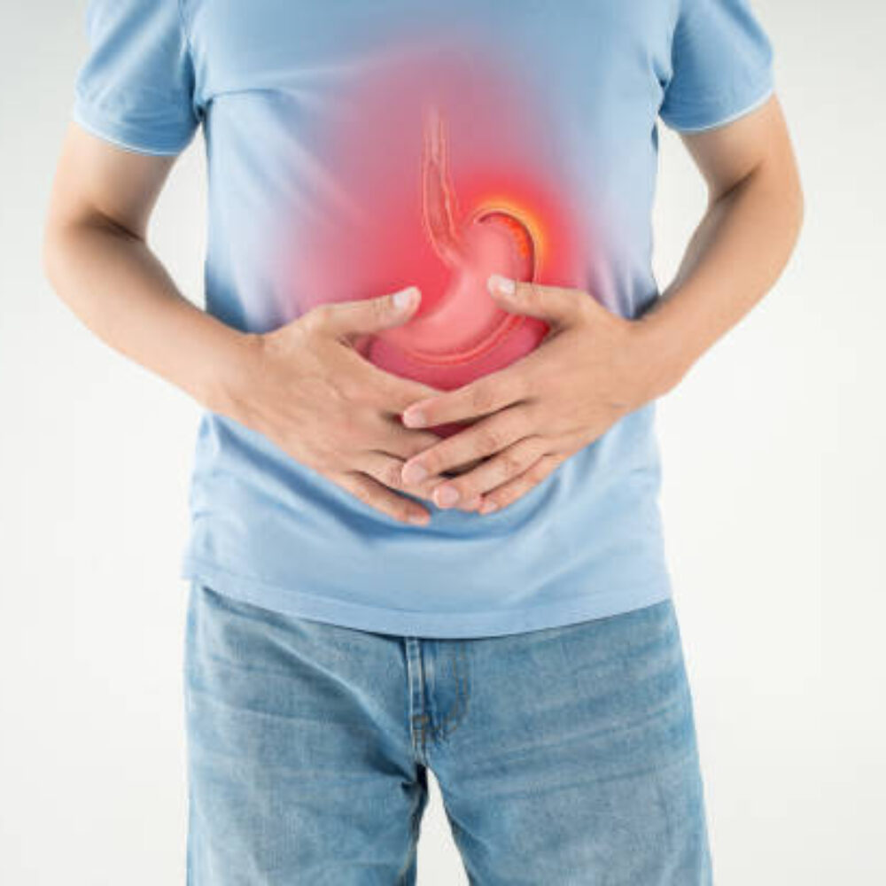 Peptic Ulcer Disease: Symptoms and How to Prevent Ulcers