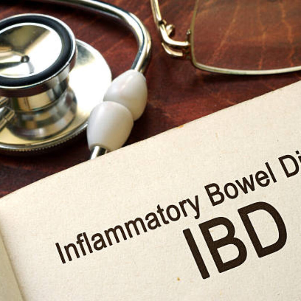 Inflammatory bowel disease[IBD]